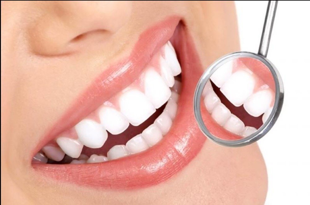 Teeth Whitening
