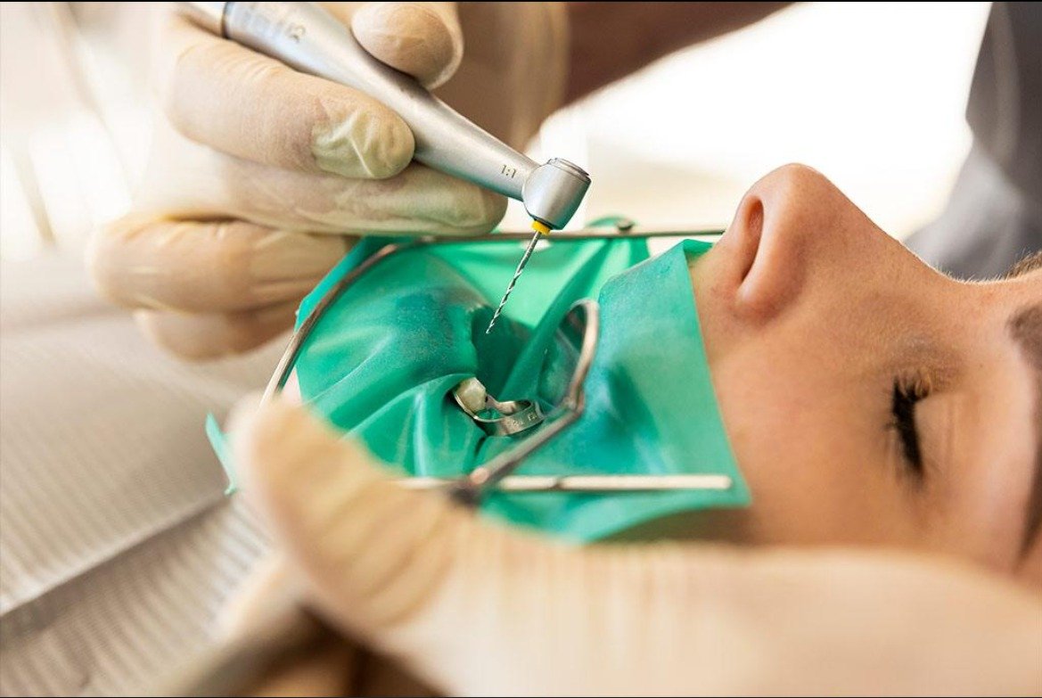 Root Canal Treatment