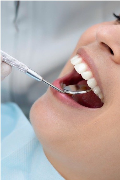 Teeth Cleaning