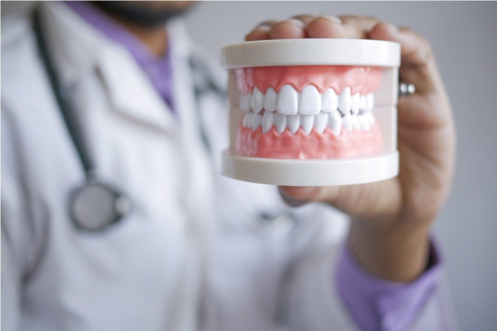 Dental Implants