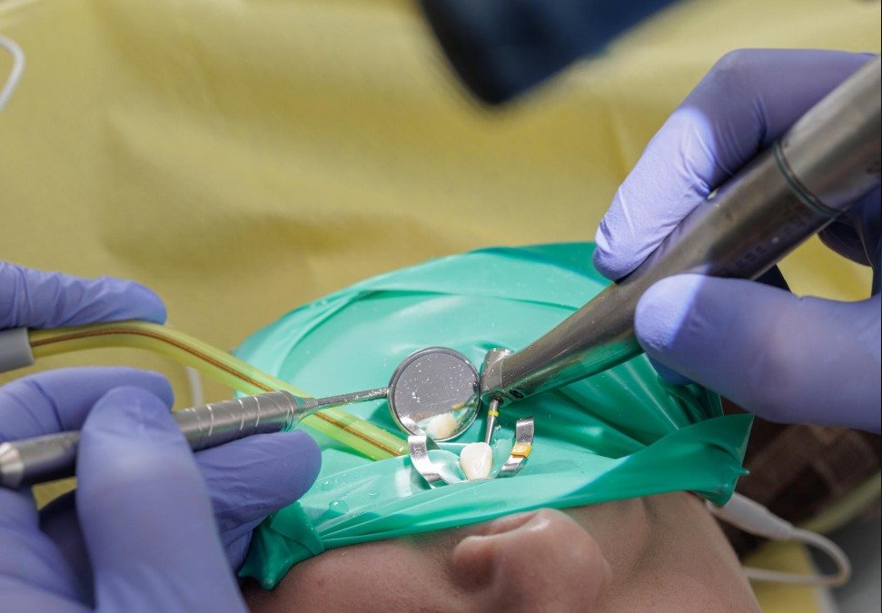 Emergency Root Canal Treatment